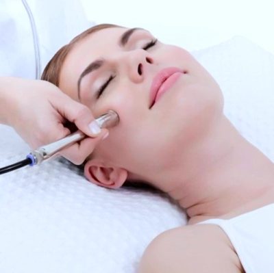 Microdermabrasion